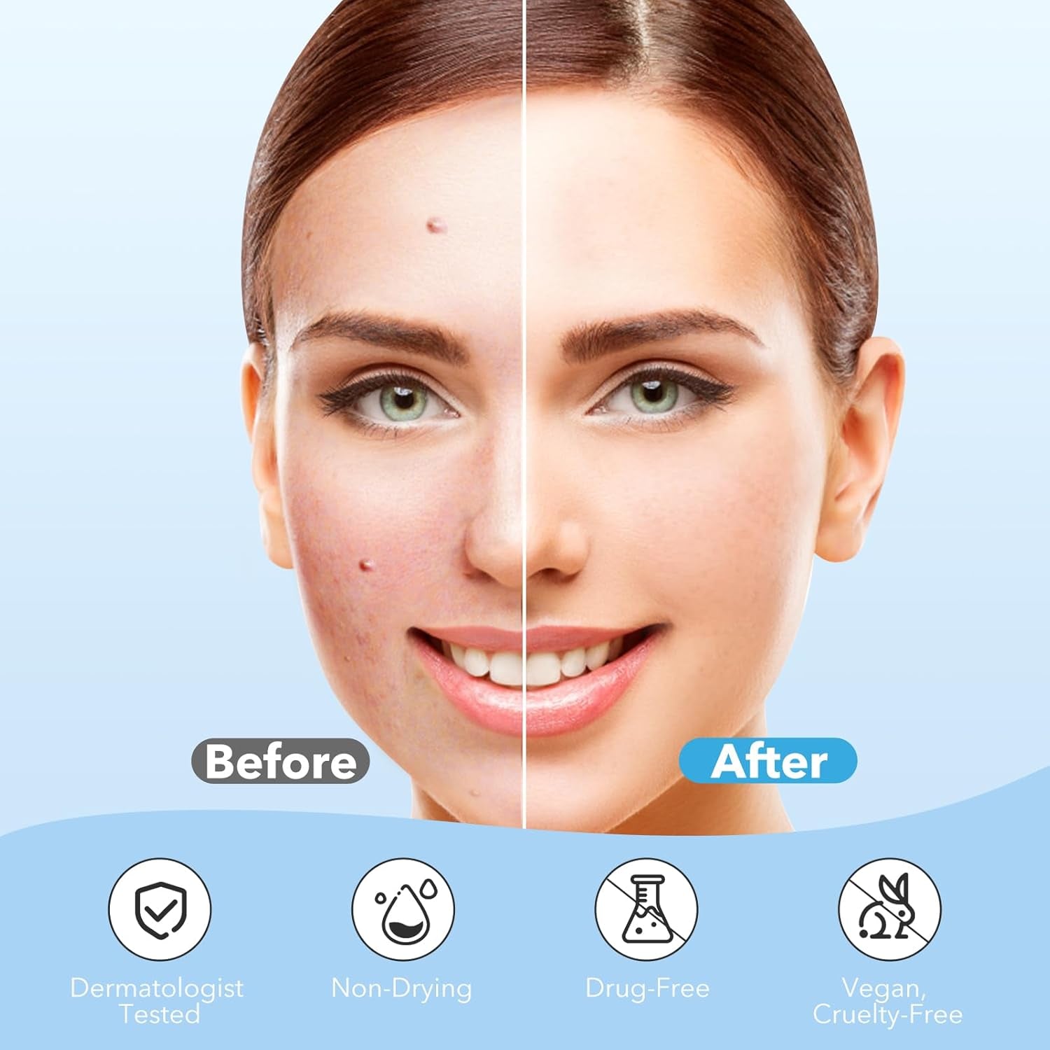 Pimple Patches for Face, Hydrocolloid Acne Patches, Cute round Shape Zit Covers, Spot Stickers with Tea Tree, Salicylic Acid & Cica Oil| 2 Sizes (9Mm, 12Mm) |288 Count